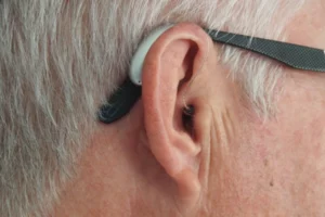 Hearing Aids trial for private patients